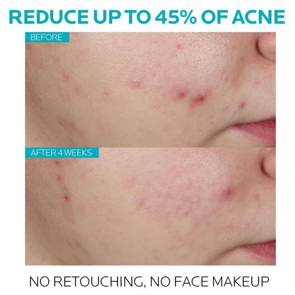 Effaclar Salicylic Acid Acne Treatment Serum - Image 5